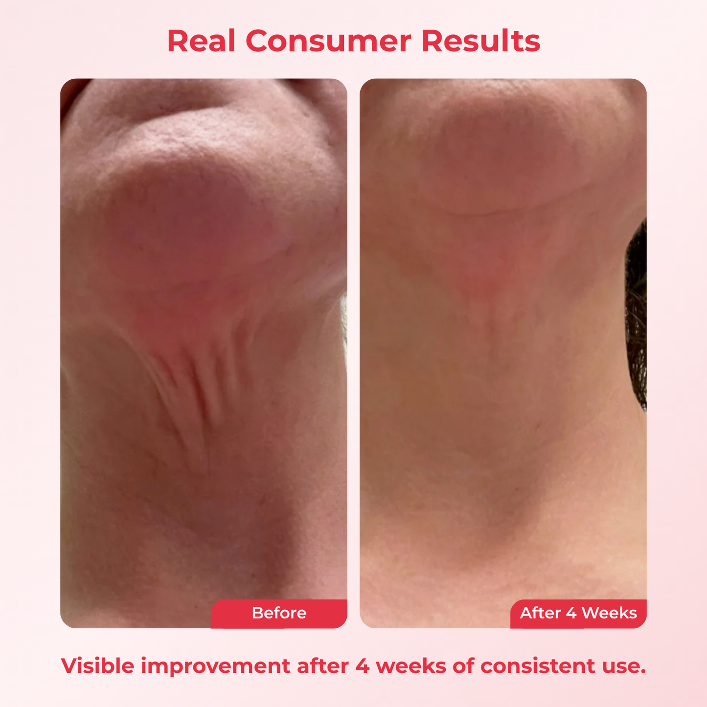 Celiderm Time Renew Neck Cream